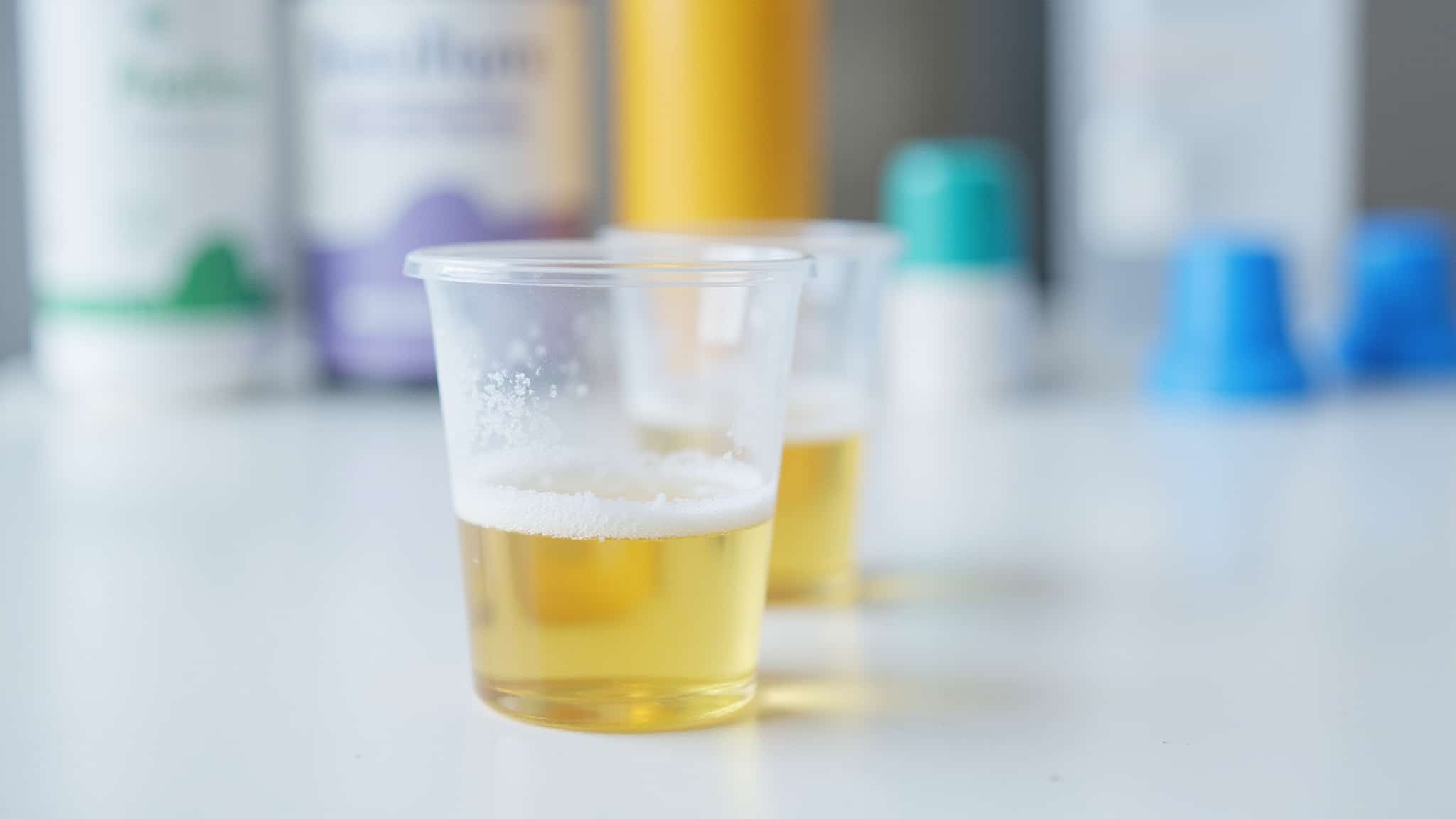 foamy or bloody urine