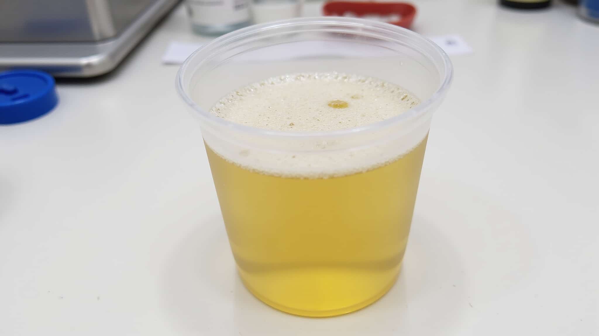 protein causes persistent foaming